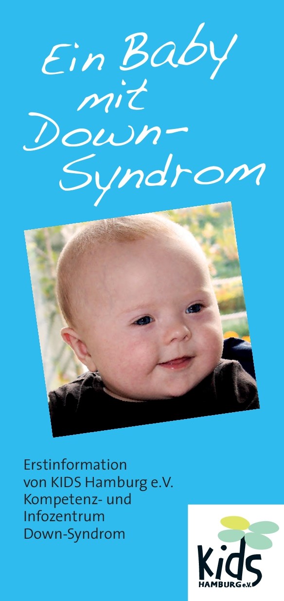 Ein Baby Mit Down Syndrom Kids Hamburg E V